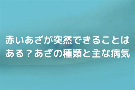 赤痣|赤いあざが突然できることはある？あざの種類と主な。